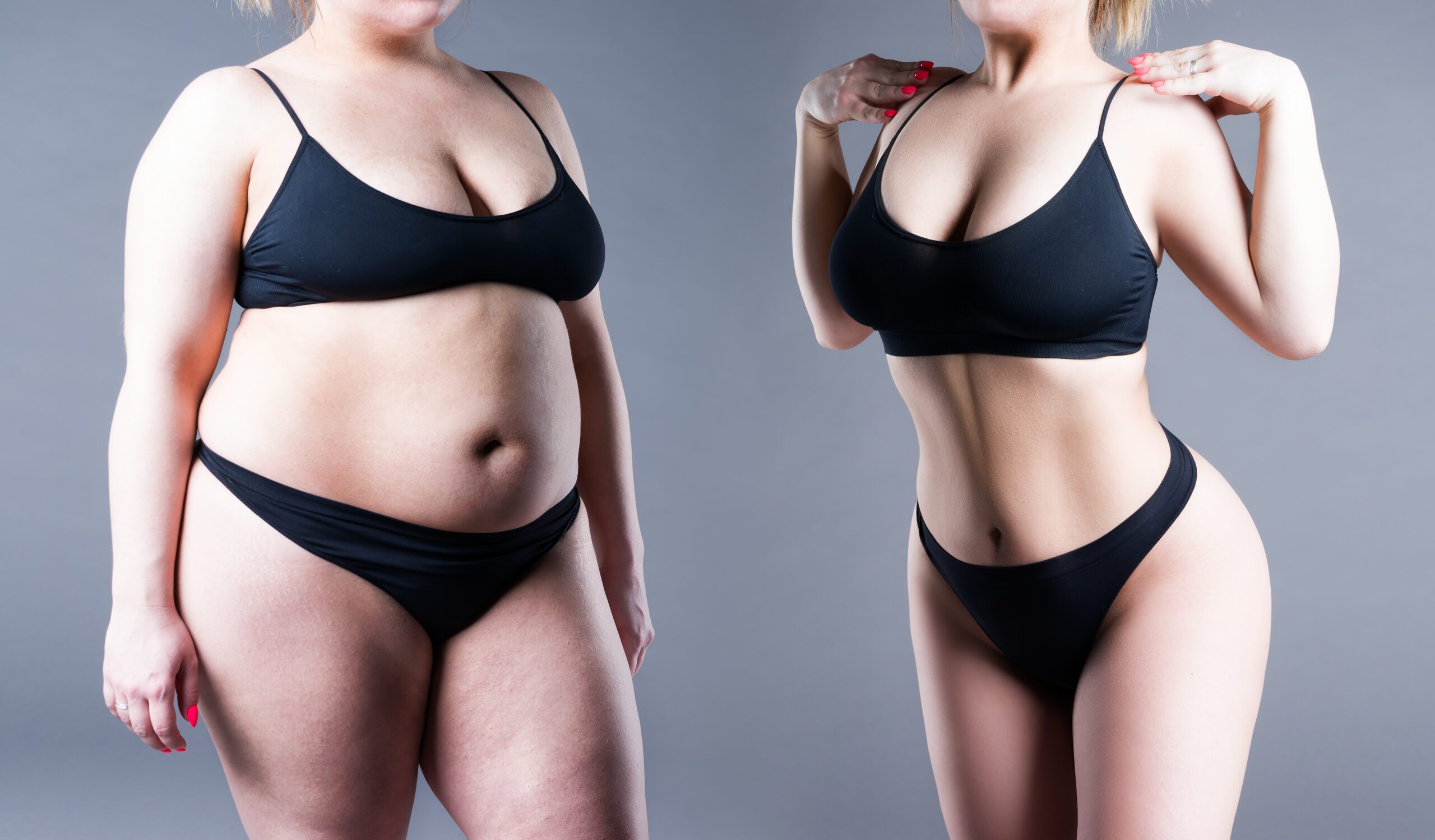 Before and after female in bikini - EMDR for Weight Loss: The ONE Thing Your Current Diet/Exercise Plan is Missing